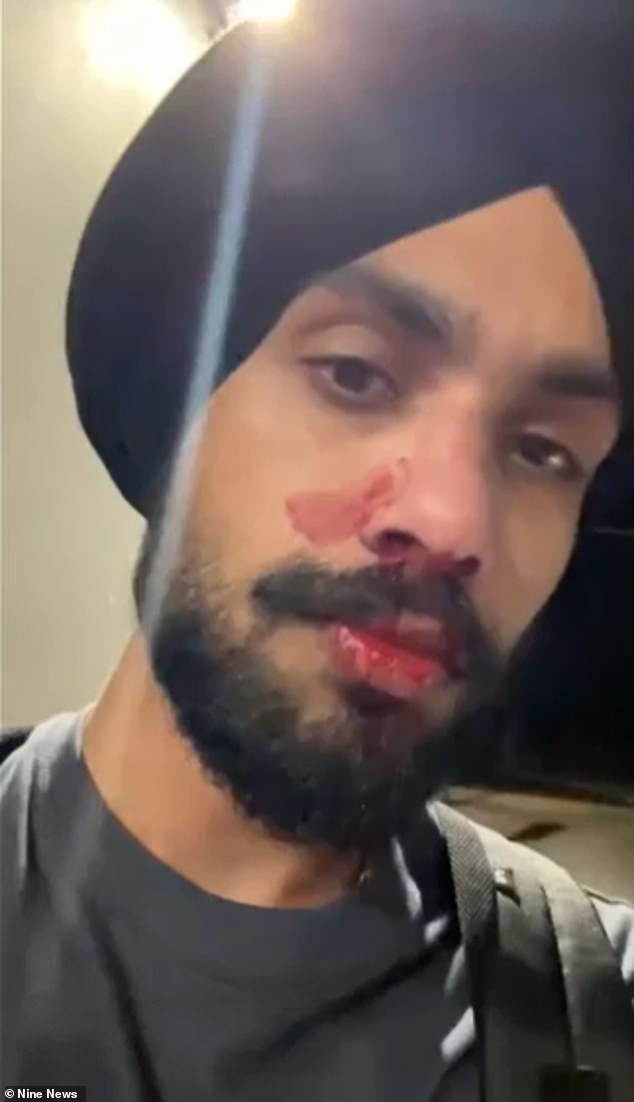 'Get back on your boat': Young nurse's nose broken after allegedly being racially abused and headbutted as he left Planet Fitness gym, Corio