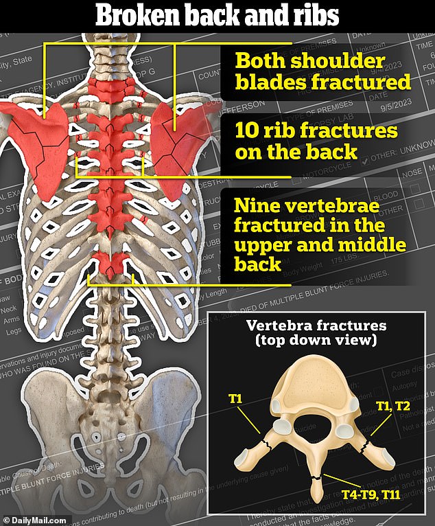 Presgrove suffered fractures to nine vertebrae in his spine, mostly at the back of the bones in the knobs you can feel if you touch your spine with your hand. There were also fractures to ten ribs - all close to the spine and mostly in the upper back
