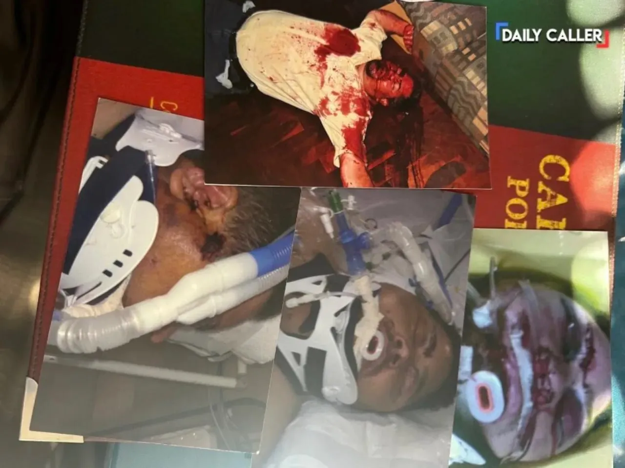 Anderson Cooper’s South Africa Report Whitewashed Brutal Reality Of Afrikaner Murders