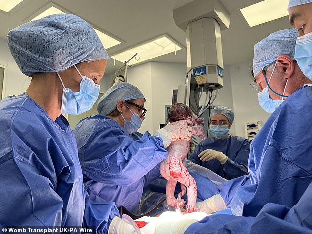Hugo being removed from his mum's transplanted womb during a C-section at Queen Charlotte's and Chelsea Hospital