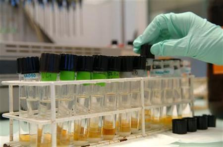 “A.G.E.S. Fall Conference” on BrightU: The “God particles” hidden in human urine