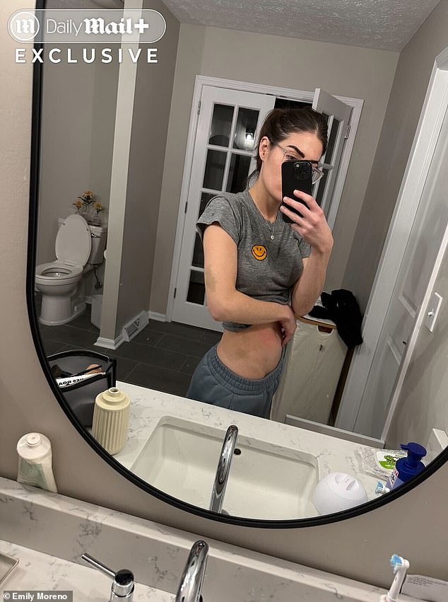 Photos obtained exclusively by the Daily Mail show the injuries Emily documented on her arms and torso the day of the alleged incident, with additional images taken the following day, February 2.