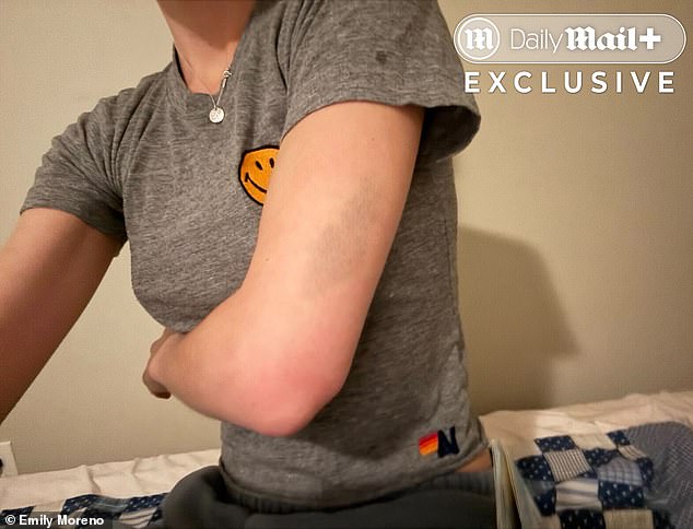 The most recent alleged attack came on February 1, when Miller allegedly grabbed and struck Emily during a custody exchange at his Ohio home, leaving bruises on her arm, elbow, and torso as the couple's two-year-old daughter, Ruth, looked on