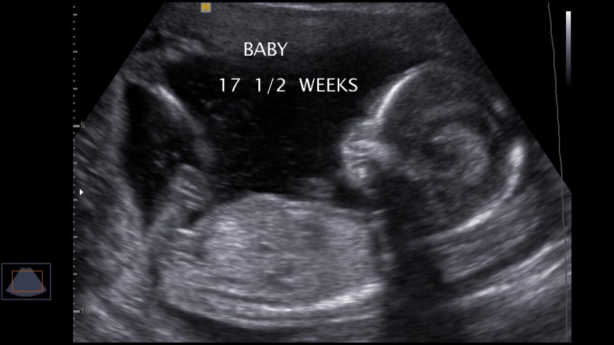 Surrogacy Is A Form Of Slavery. It Should Be Abolished