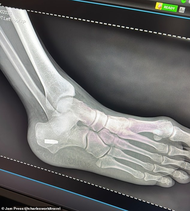 An X-ray showed the bullet lodged inside Mr Wright's foot following the shooting