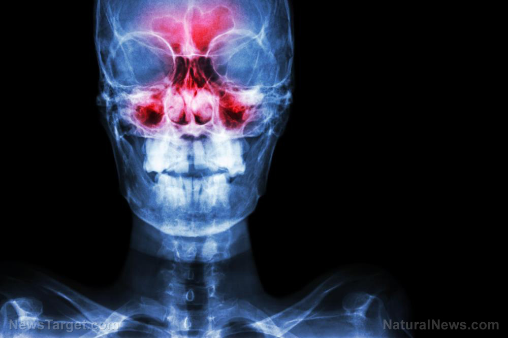 &amp;amp;#8220;ATB Personal Restoration Class&amp;amp;#8221; on BrightU: Burning away the darkness &amp;amp;#226;&amp;amp;#128;&amp;amp;#147; the point that claims to consume negative thoughts