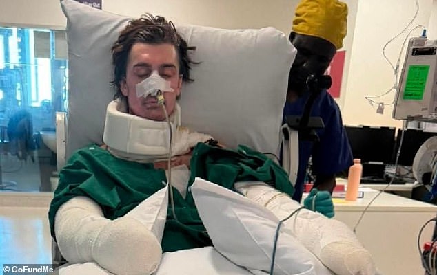 Mr Perrem (above) suffered burns to 75 per cent of his body