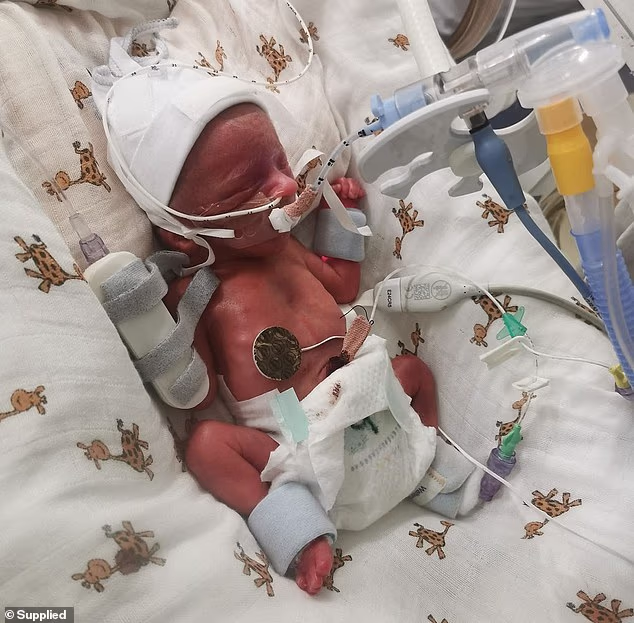 Brave toddler who nearly died when she was born premature and has spent more than half her 27-month life in hospital enjoys first holiday thanks to tech upgrade