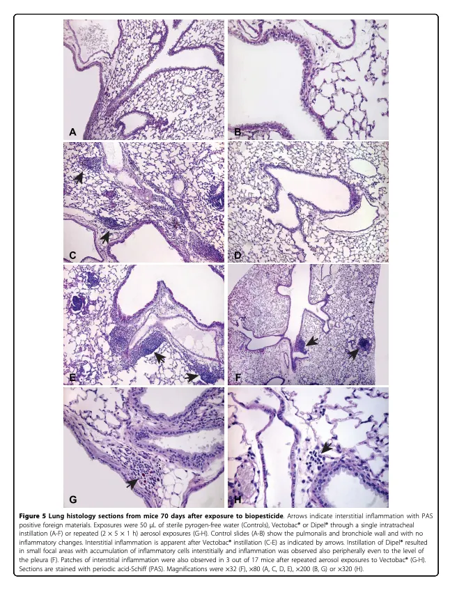 Figure 5, 2010 BMC Microbiology study: Microscopic images of mouse lung tissue 70 days after exposure to commercial Bacillus thuringiensis biopesticides.