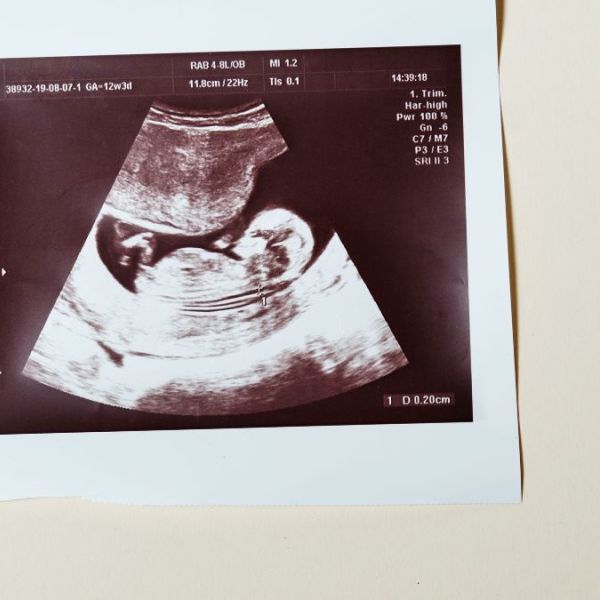 Missouri Senate Opens The Door To Replace Recently Passed Radical Abortion Amendment